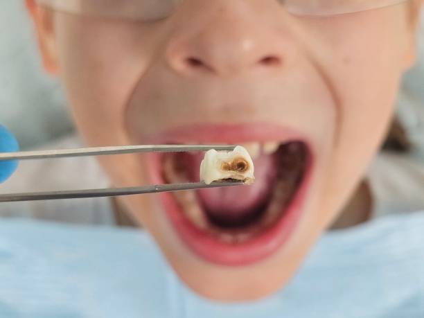 Best Weekend Emergency Dentist in East Brooklyn, CT